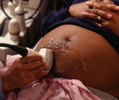 Ultrasound in Mandeville — Hargreaves Hospital