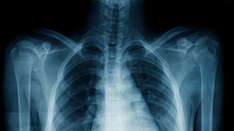 Fast, reliable X-ray — Hargreaves Hospital