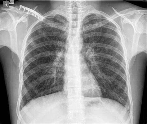 X-ray at Hargreaves Hospital, Mandeville